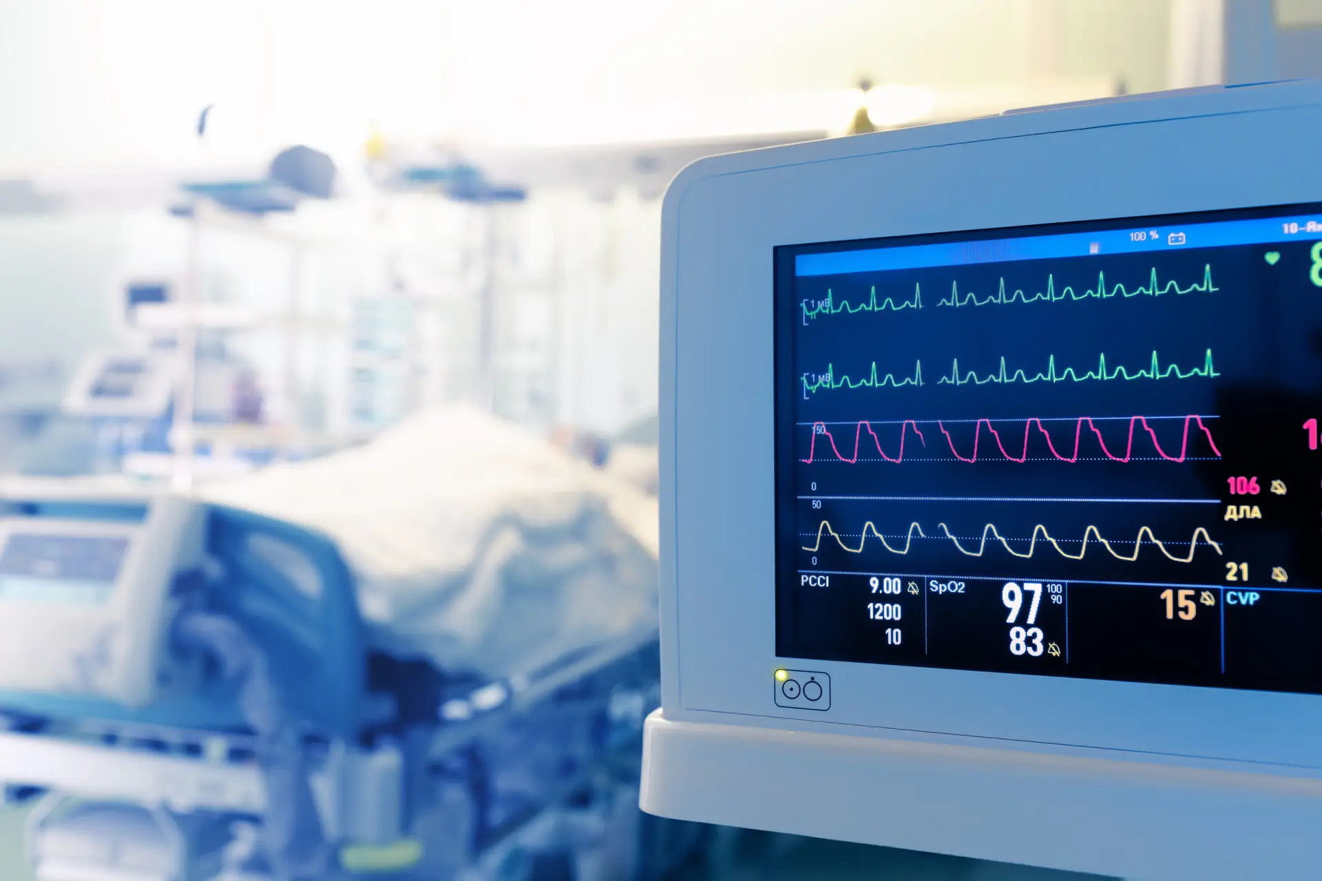 heart monitor in a hospital room